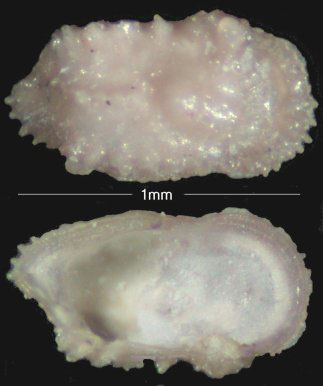 Ostracod, Cythereis folkestonensis